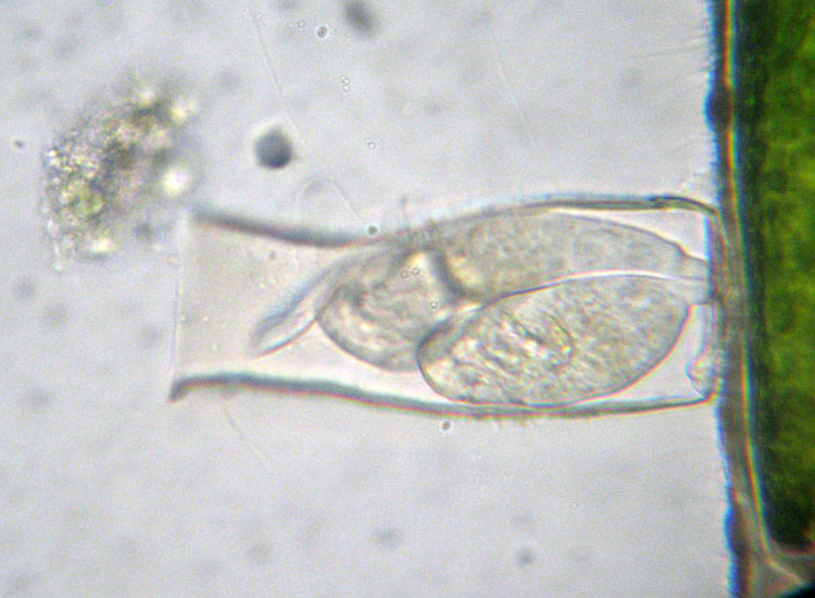 Microscopia salata